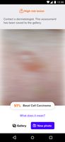 2. Detect health risk by assessing lesion with AI.