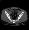 Step 1. Original CT image