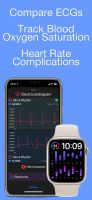 Heart Analyzer screenshot 2