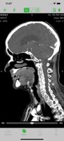 OsiriX screenshot 1