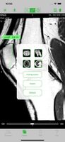 OsiriX screenshot 3