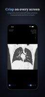 Coronal lung view on a phone