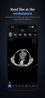 CT viewer with series strip and window presets