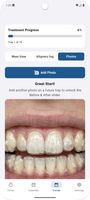 Teeth photo comparison.