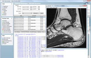 Mirth Connect screenshot 1