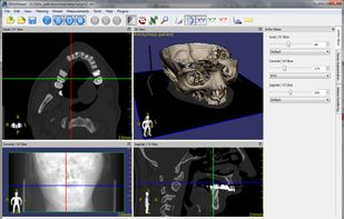 3DimViewer screenshot 1