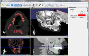 3DimViewer screenshot 3