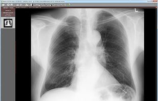 RadiAnt DICOM Viewer screenshot 1