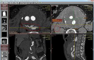 RadiAnt DICOM Viewer screenshot 2