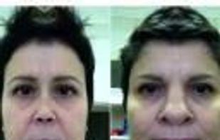 Echoism screenshot 1