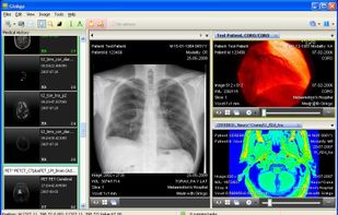 Ginkgo CADx screenshot 1