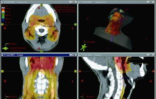 Varian Eclipse screenshot 2