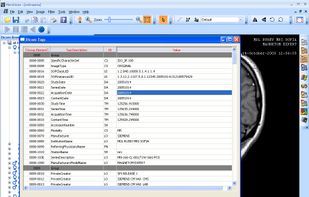 MicroDicom screenshot 1