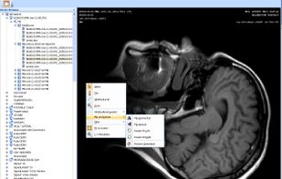 MicroDicom screenshot 2