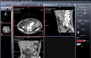 Hipax Diagnostic Workstation screenshot 1