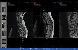 Athena DICOM Viewer screenshot 3