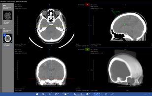Athena DICOM Viewer screenshot 2