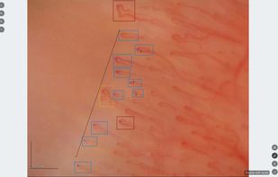 Capillary.io screenshot 1