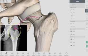 Complete Anatomy screenshot 3