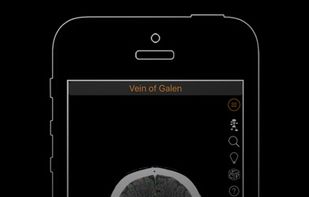 CT Anatomy screenshot 1