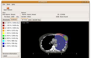 dicompyler running on Ubuntu Linux