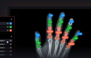 Datature screenshot 1