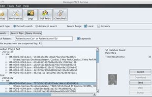 DICoogle screenshot 1