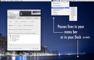 Pauses' configuration window