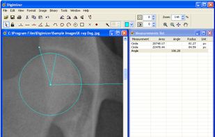 Digimizer screenshot 2