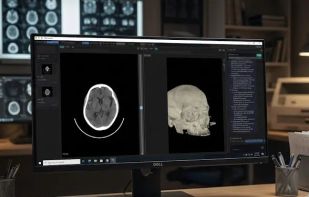 Donut DICOM Viewer screenshot 2