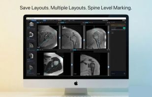 Donut DICOM Viewer screenshot 1