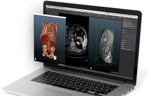 Dornheim Segmenter screenshot 2