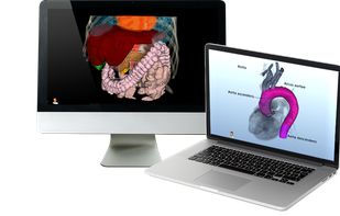 Dornheim Segmenter screenshot 3