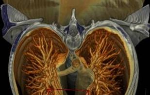 Drishti screenshot 3