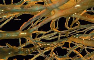 Drishti screenshot 2