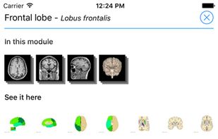 e-Anatomy screenshot 3