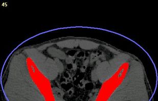 Step 2. Segmentation