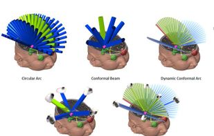iPlan RT screenshot 1