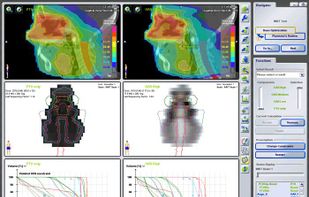 iPlan RT screenshot 3