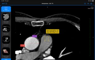 Falcon Viewer screenshot 3