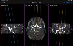 Falcon Viewer screenshot 1