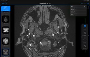 Falcon Viewer screenshot 2