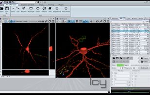 Main graphical interfafce, with a synchronised 2D and 3D view of the same data (a fluorescent neuron in 3D)