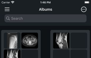 IDV - IMAIOS DICOM Viewer screenshot 1