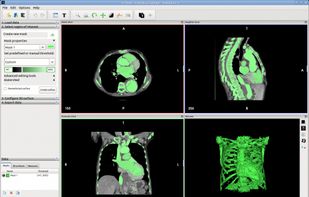 Segmentation and 3D mesh