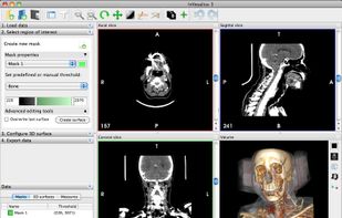 Multislice view and Volume Rendering