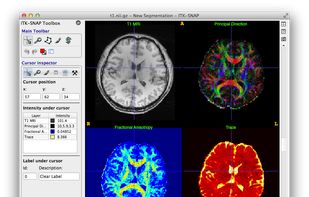 ITK-SNAP screenshot 1