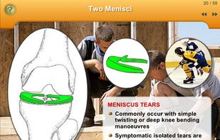 Knee Pain screenshot 2