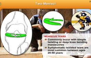 Knee Pain screenshot 1