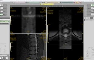 LIFEx screenshot 1